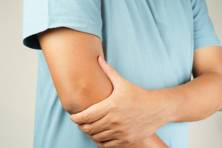 Man holding arm